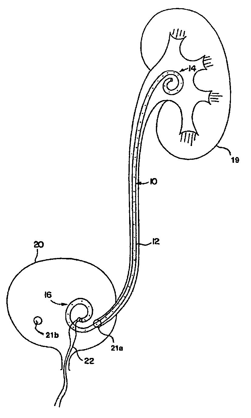 Medical devices for treating urological and uterine conditions