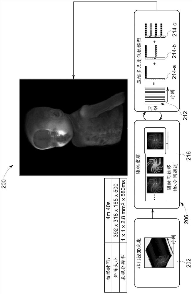 Mute multi-gradient echo dynamic magnetic resonance imaging system and method