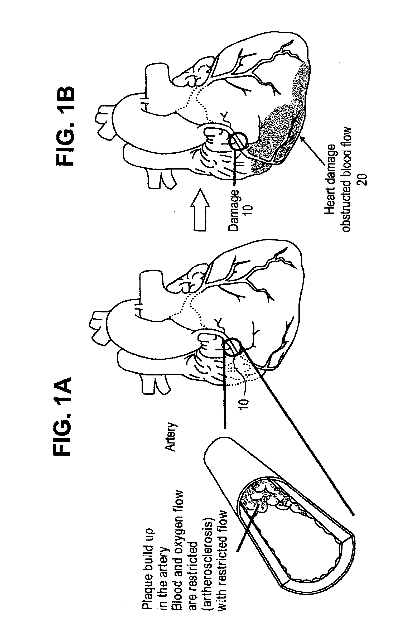 Methods and Compositions for Treating Post-Cardial Infarction Damage