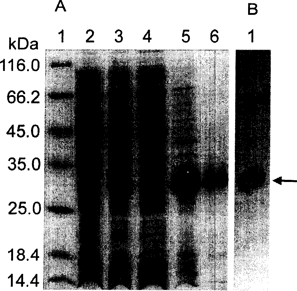 Heavy chain and light chain variable region gene of human B lymphocyte stimulation factor monoclonal antibody and its application