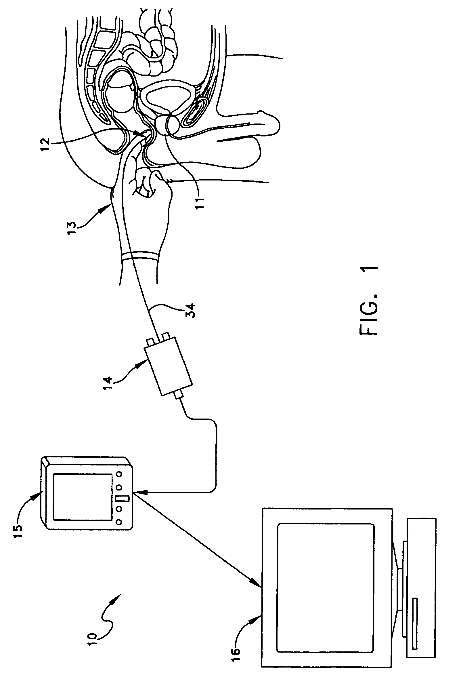 Apparatus and method for measuring the dimensions of the palpable surface of the prostate