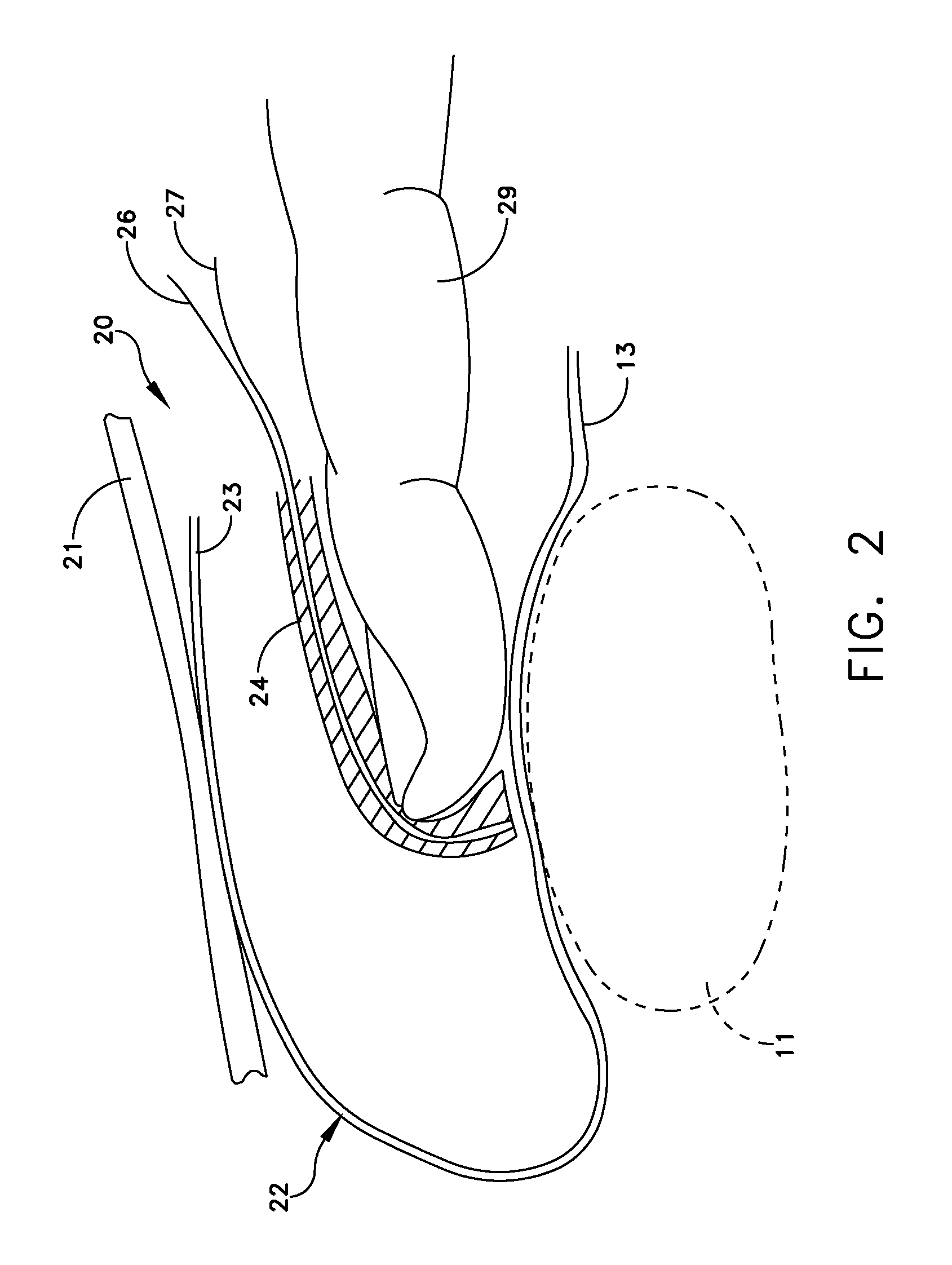 Apparatus and method for measuring the dimensions of the palpable surface of the prostate