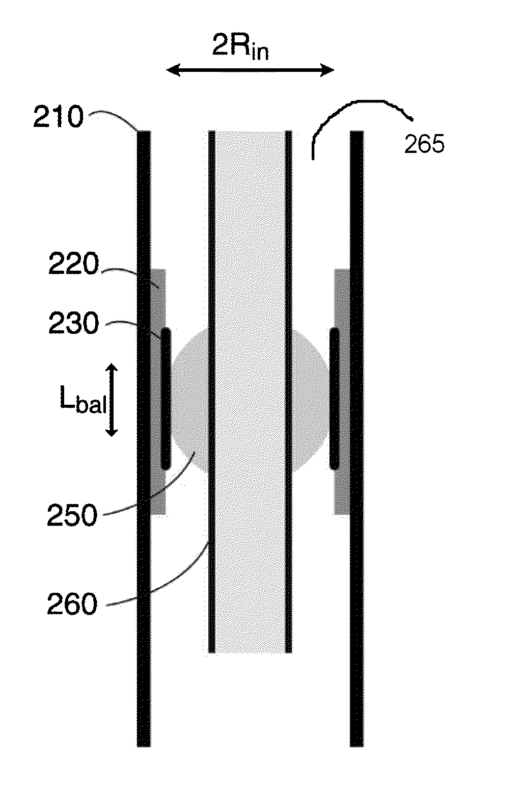 Method and apparatus for protection of trachea during ventilation