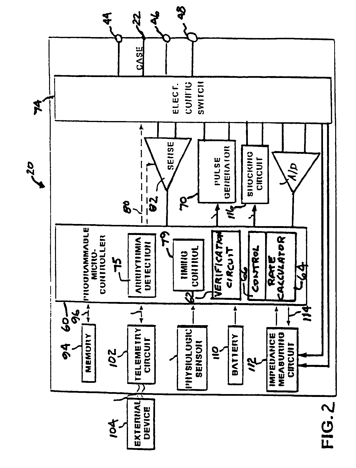 Subcutaneous cardiac stimulation device, system, and method providing accelerated arrhythmia detection verification and transient rate compensation
