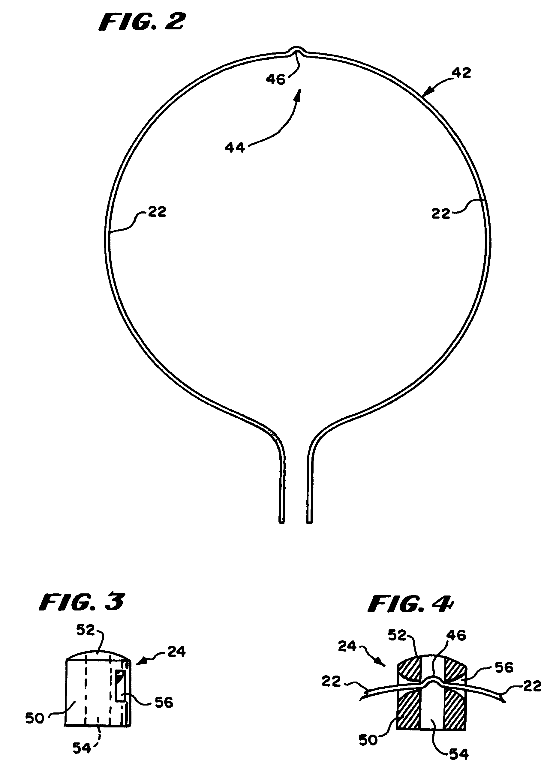 Surgical method and apparatus for positioning a diagnostic or therapeutic element within the body