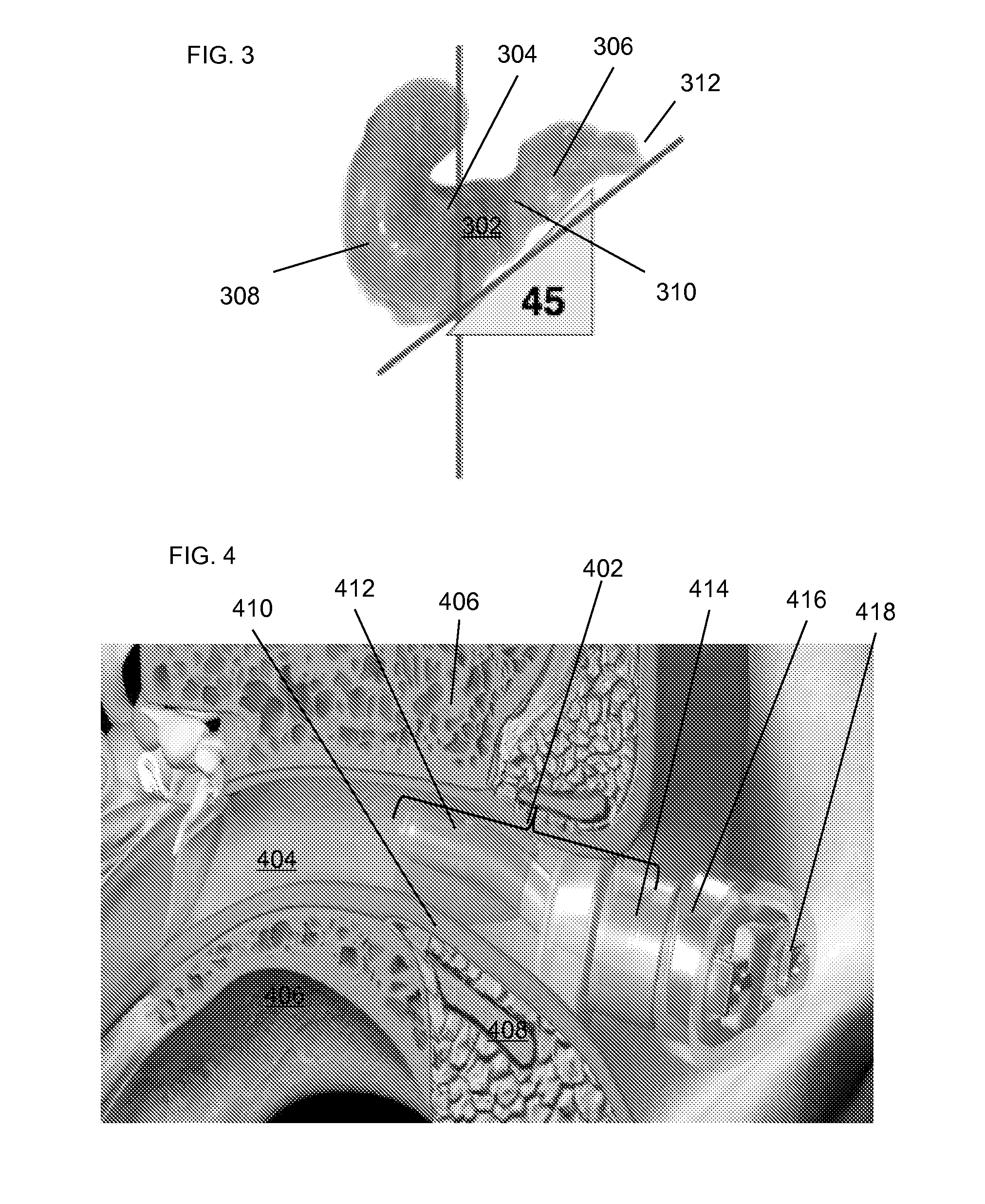 Method and device for acoustic sealing and occlusion effect mitigation