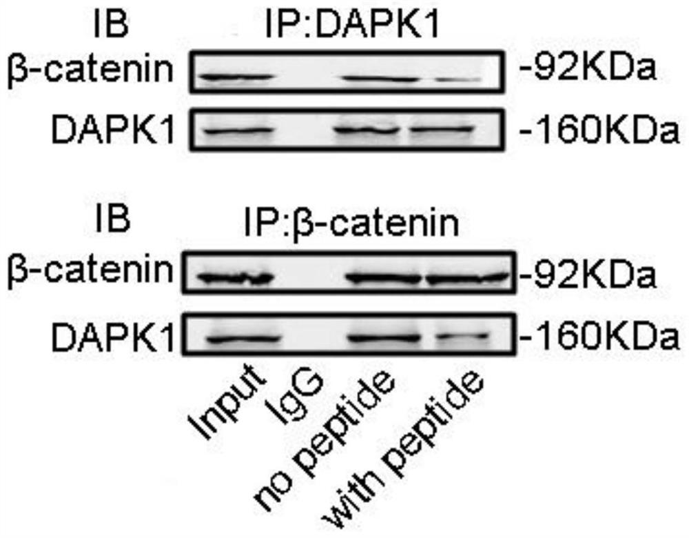 A brain-penetrating polypeptide and its application in the preparation of drugs for preventing and treating senile dementia