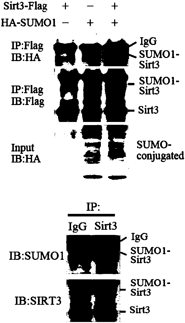 Modulation and control of SENP1 phosphorylated modified compound and SIRT3 SUMOylation modified compound and application of SENP1 phosphorylated modified compound and SIRT3 SUMOylation modified compound