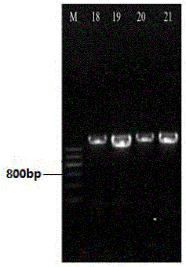 A kind of method for detecting Lactobacillus casei bacterial strain and its kit and primer pair