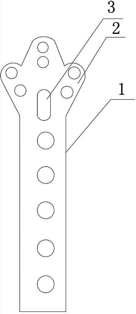 Clover titanium plate fixing structure and method of femoral intertrochanteric fracture