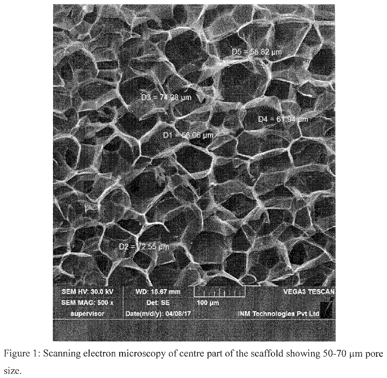 Scaffold compositions for tissue repair