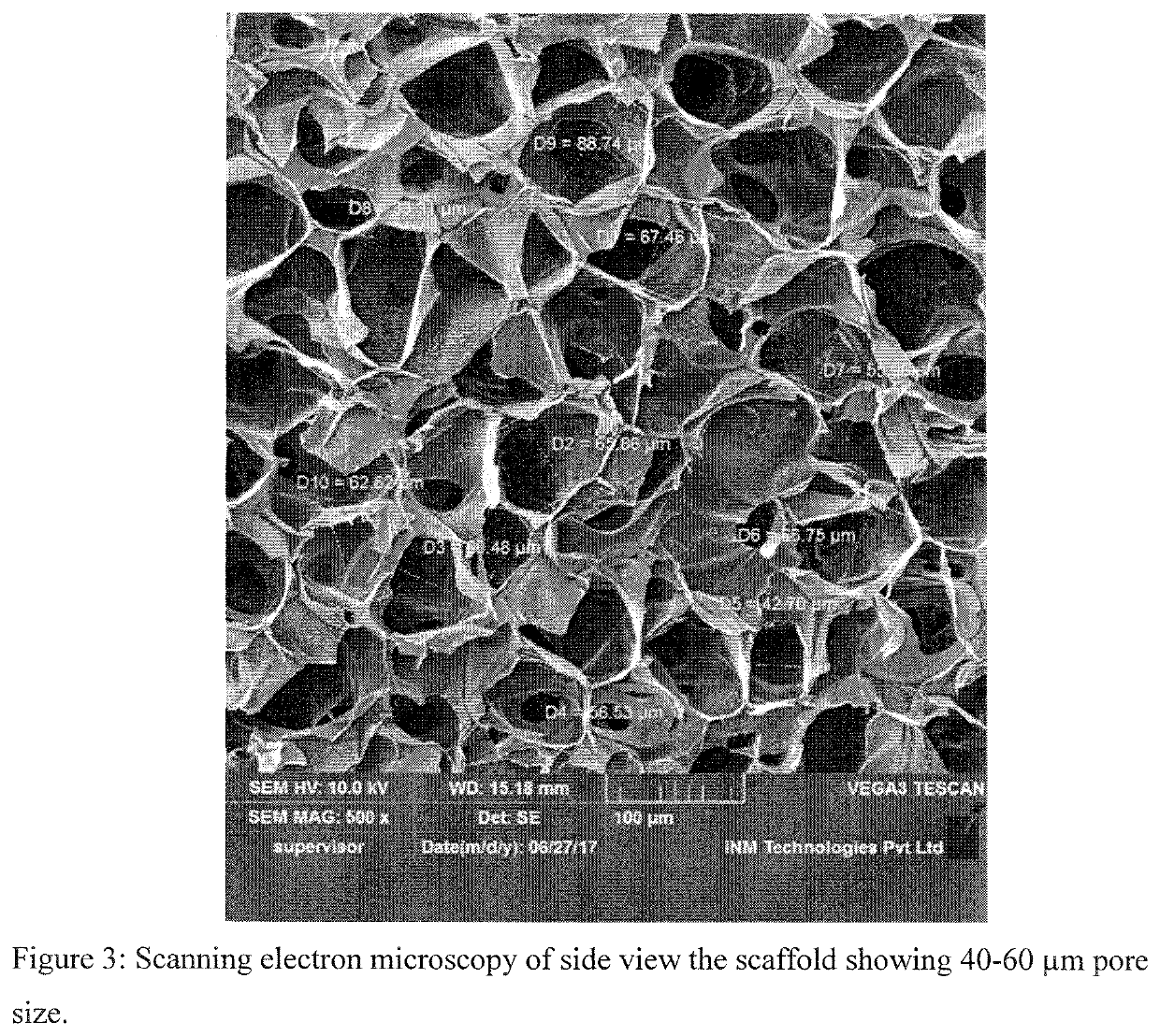 Scaffold compositions for tissue repair