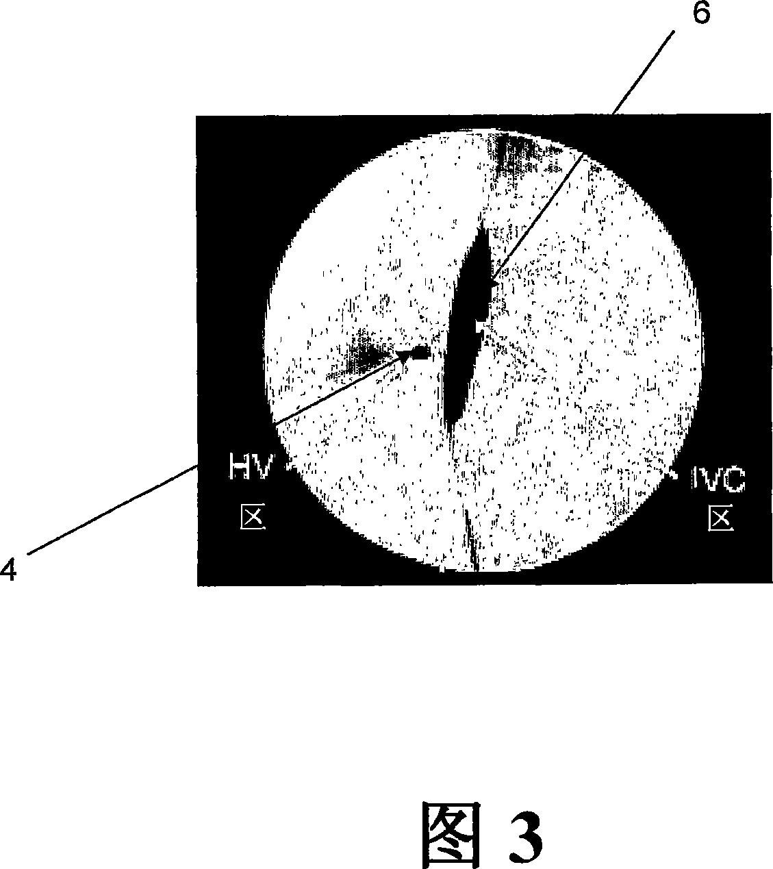 Methods for targeted delivery of genetic material to the liver
