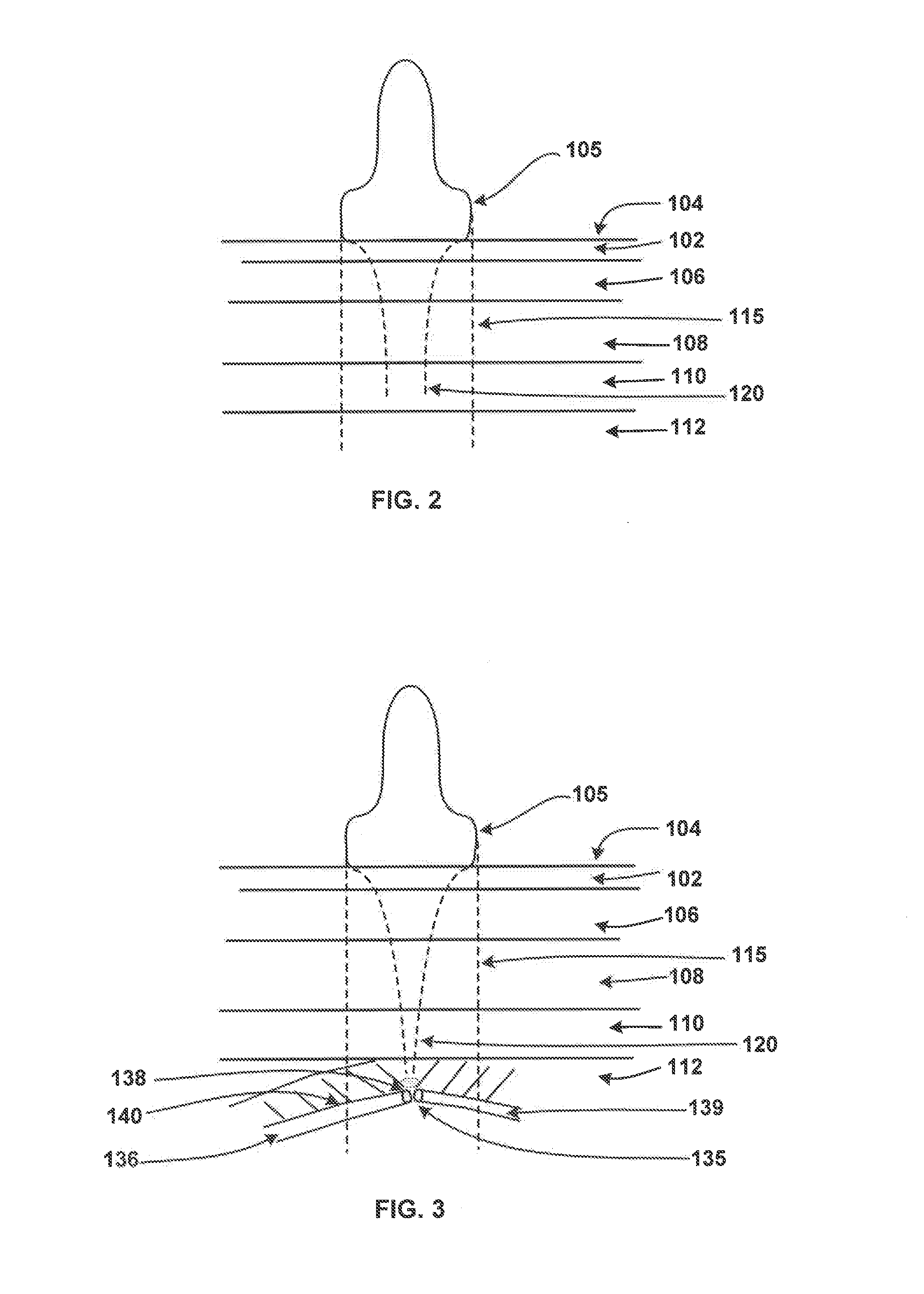 System and Method for Treating Cartilage and Injuries to Joints and Connective Tissue