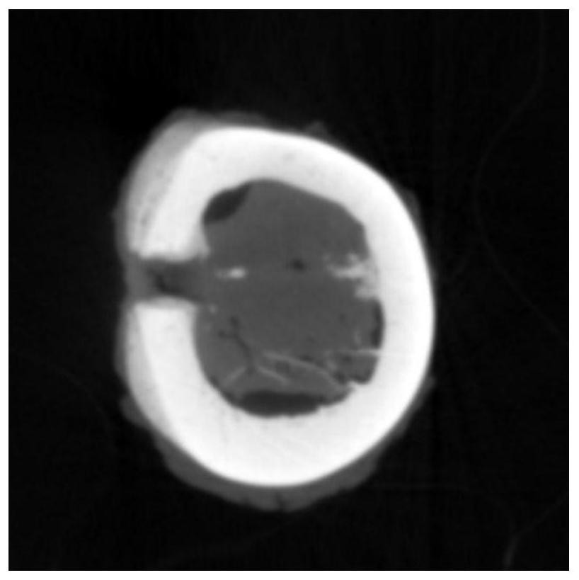 A kind of absorbable reinforced bone implant material and its preparation method