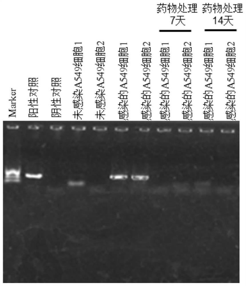 Medicinal preparation for resisting intracellular mycoplasma infection and application thereof