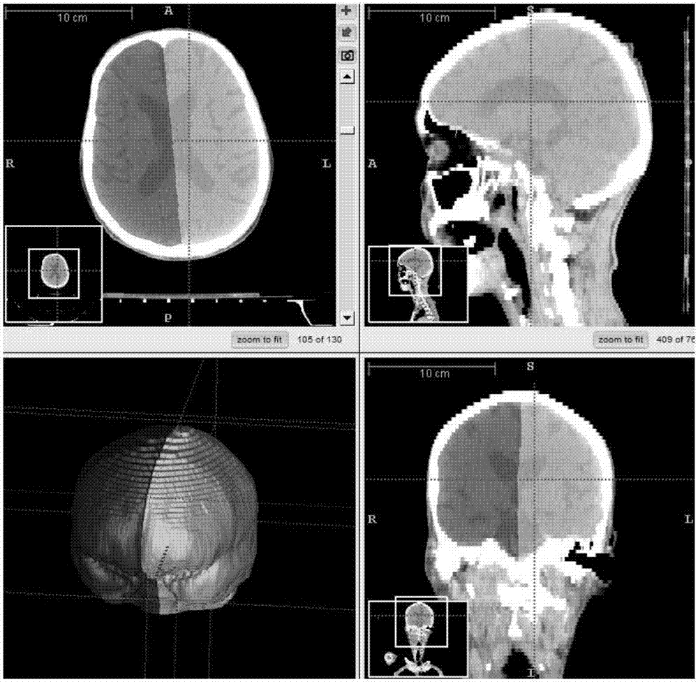Left and right cerebral hemisphere segmentation method