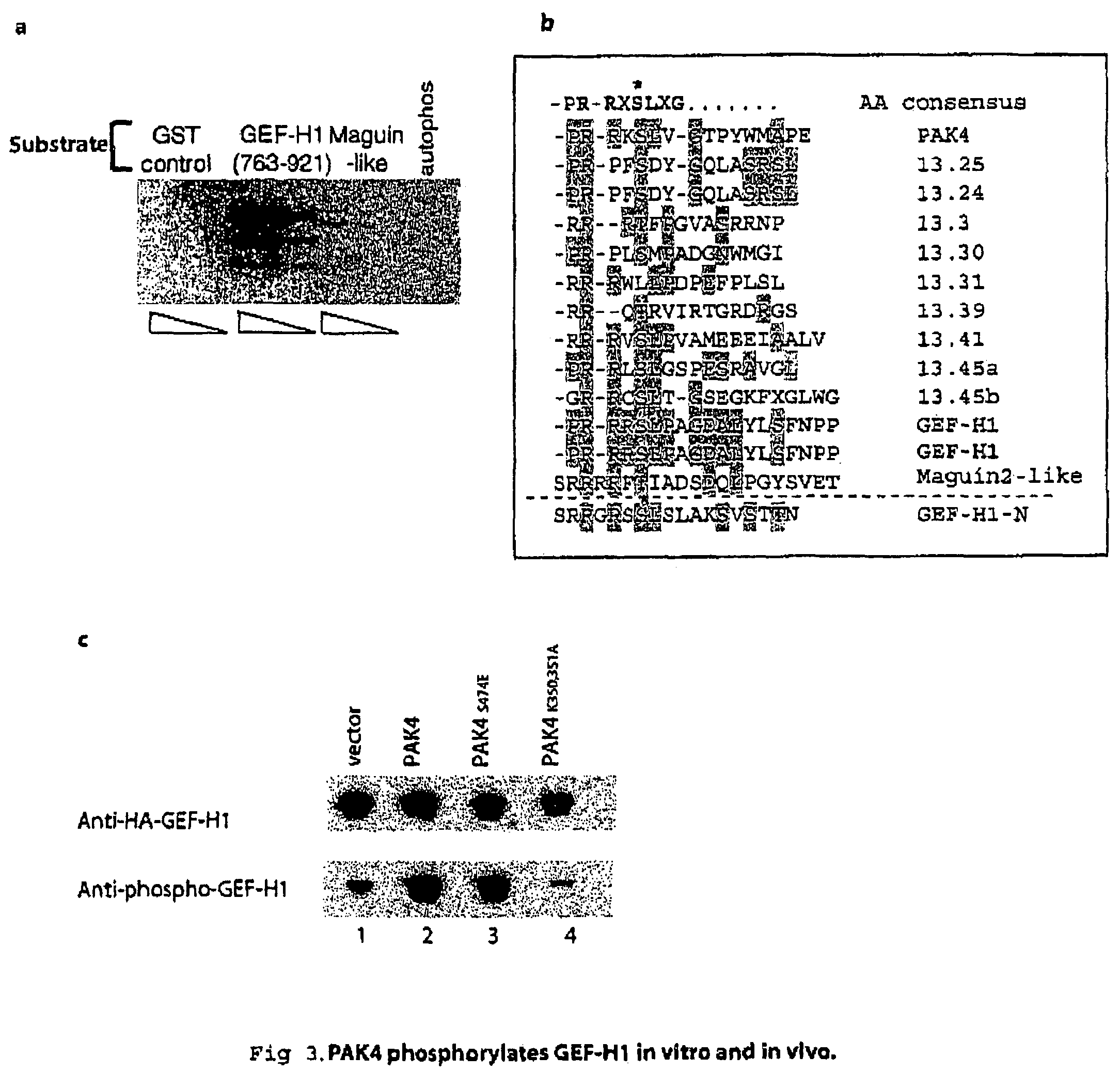 GEF-H1b: biomarkers, complexes assays and therapeutic uses thereof