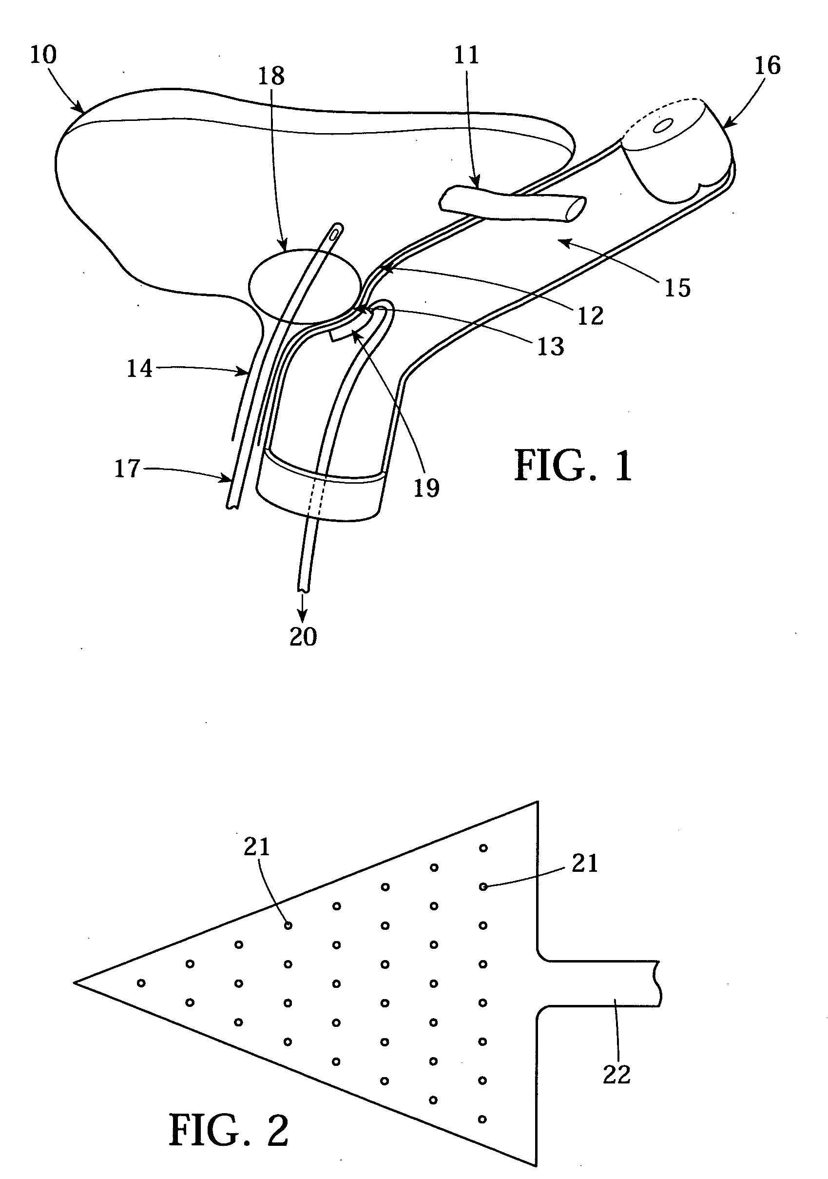 Method and device for delivering drug to the trigone of the bladder