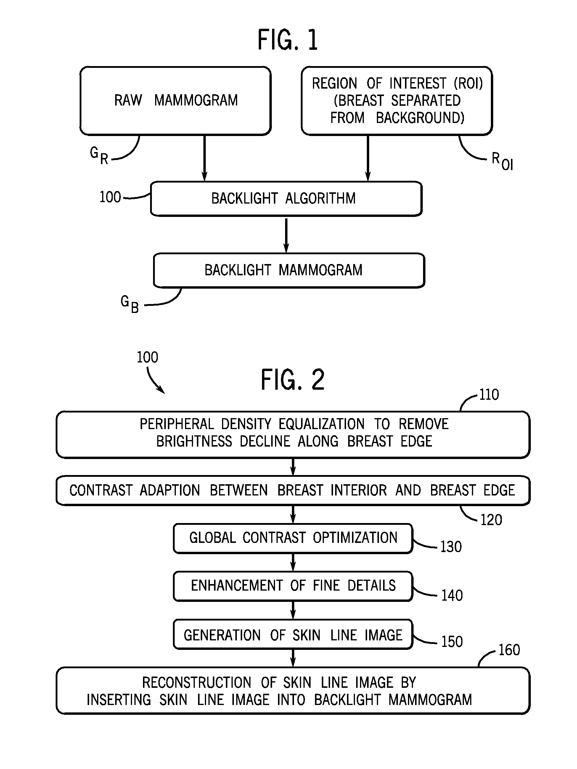 Method and Apparatus for Processing Digital Mammographic Images