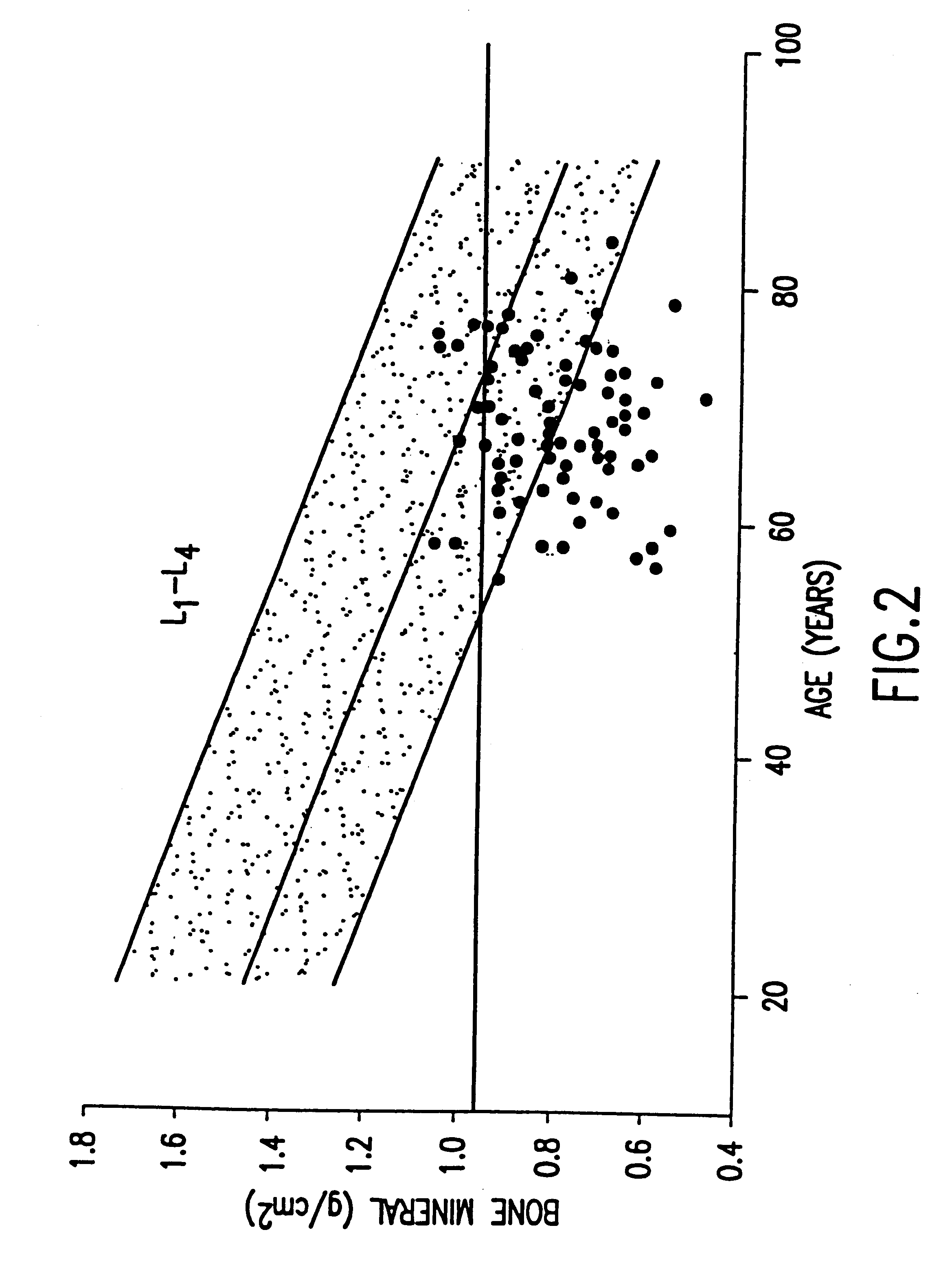 Method and composition for the treatment of osteoporosis