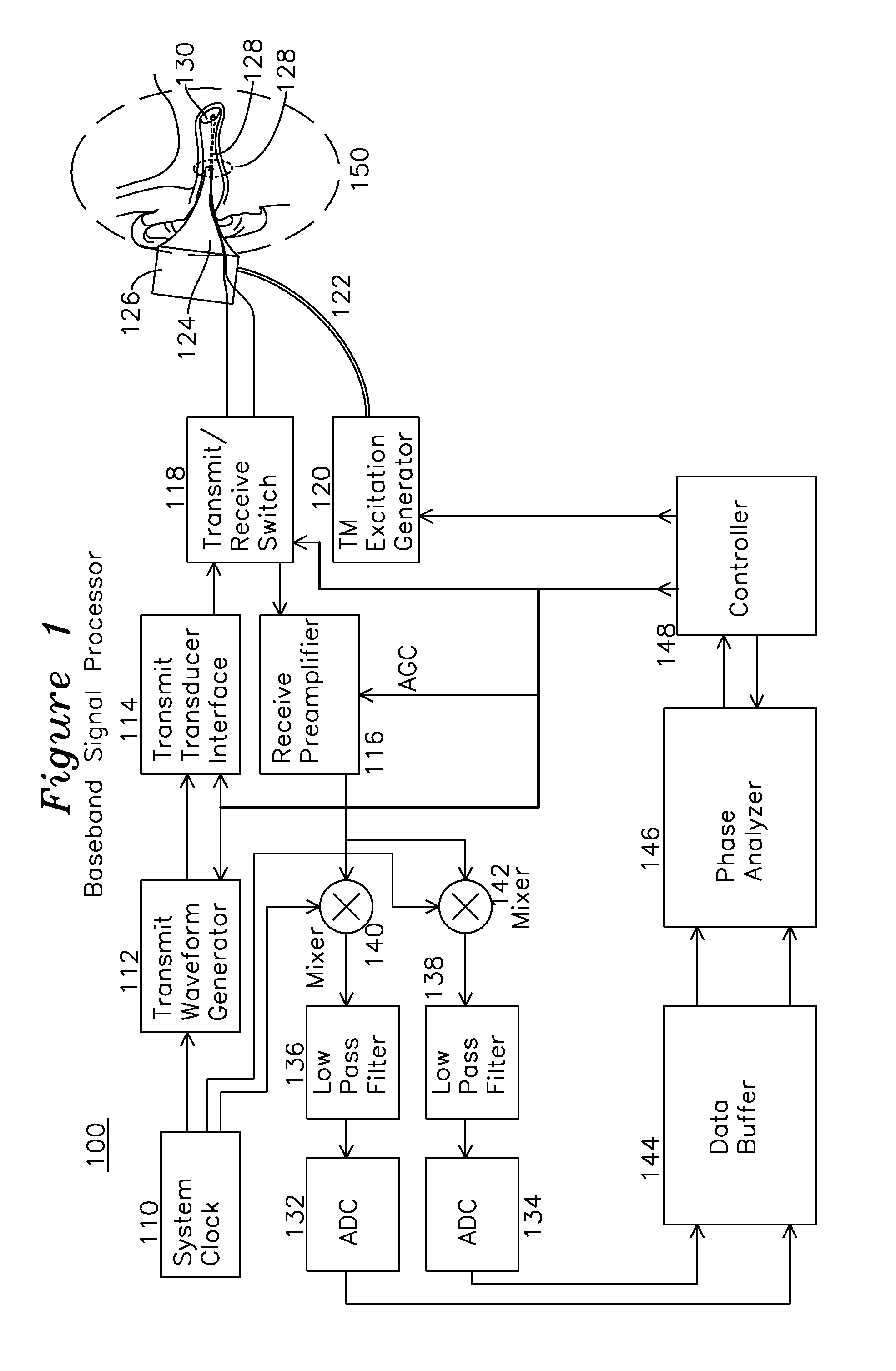 Apparatus and Method for Characterization of Acute Otitis Media