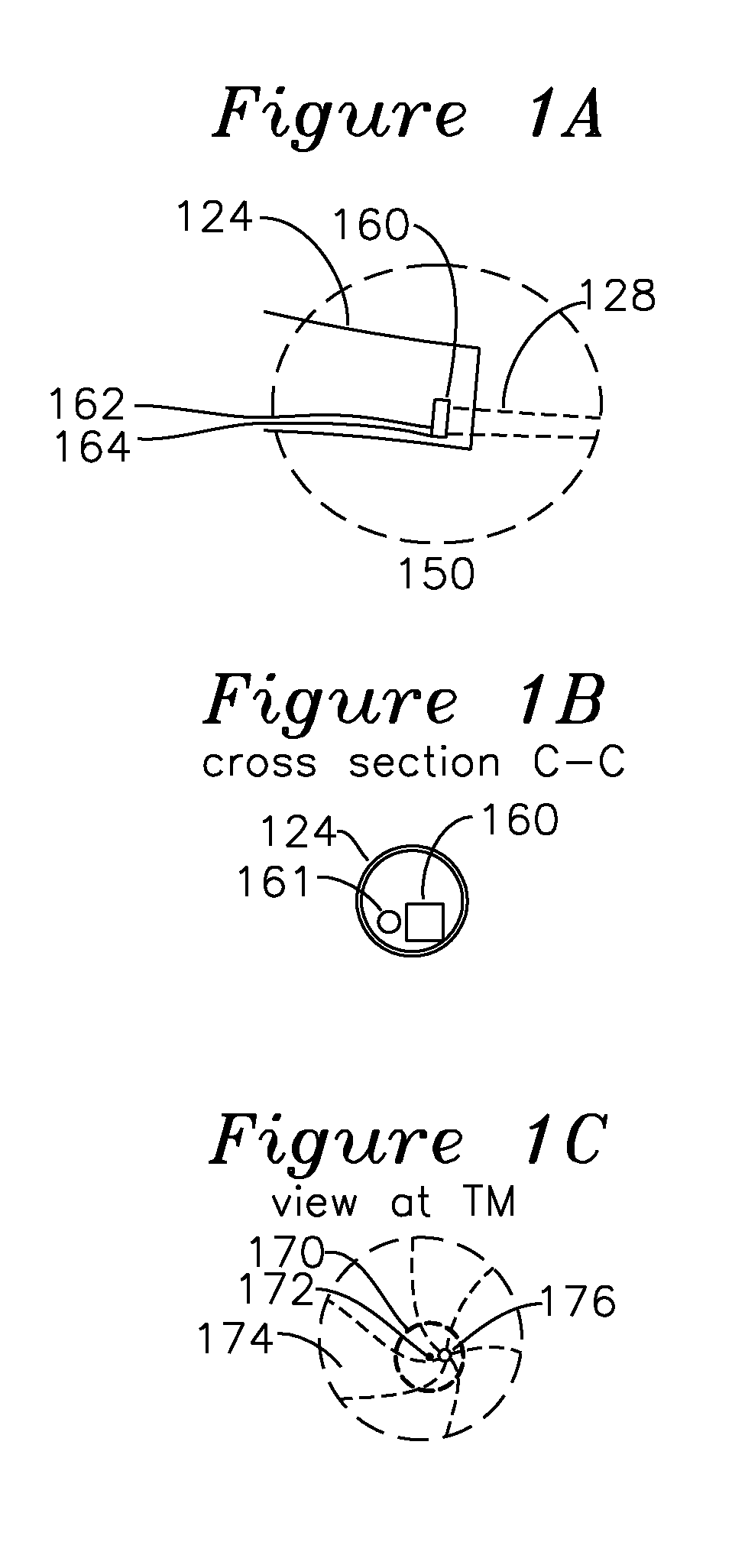 Apparatus and Method for Characterization of Acute Otitis Media