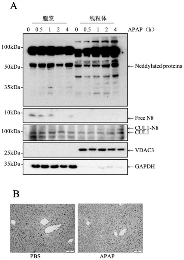 Application of MLN4924 in preparation of medicine for preventing or treating APAP-induced acute liver injury