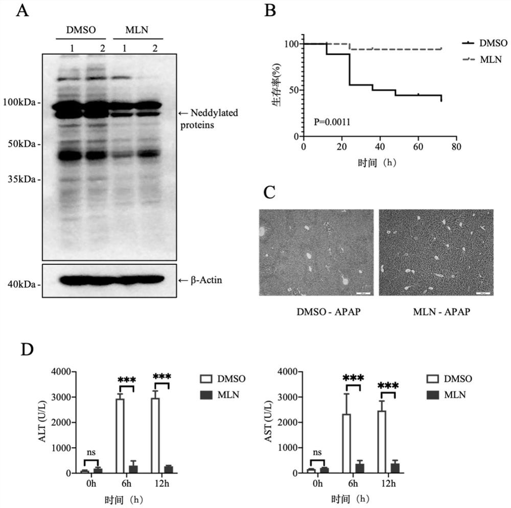 Application of MLN4924 in preparation of medicine for preventing or treating APAP-induced acute liver injury