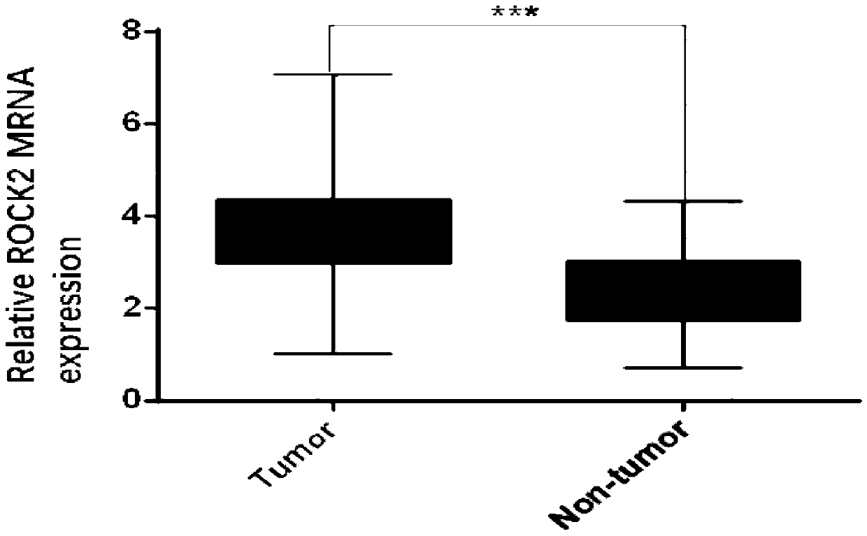 Application of ROCK2 to preparation of TRAIL reverse tolerance medicines for treating reverse osteosarcoma cells