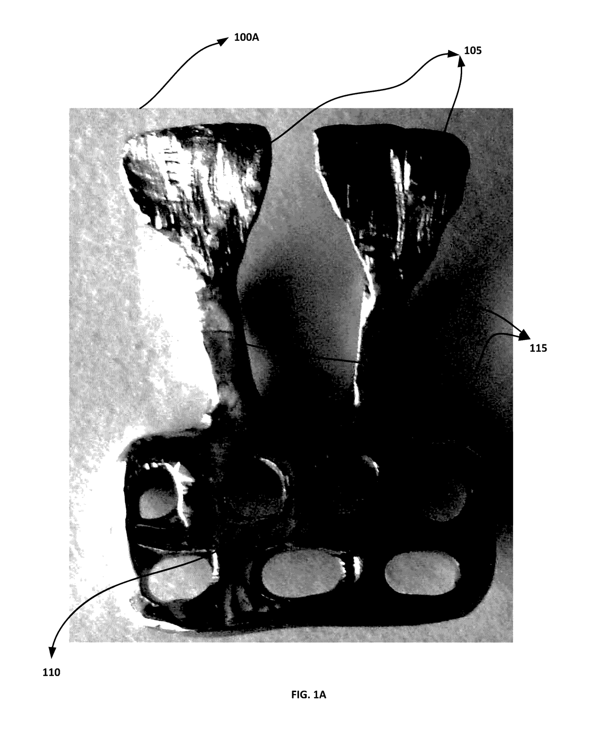 Orthodontic appliance for distalization and/or space closure