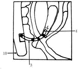 Visualization endoscopic incision knife device