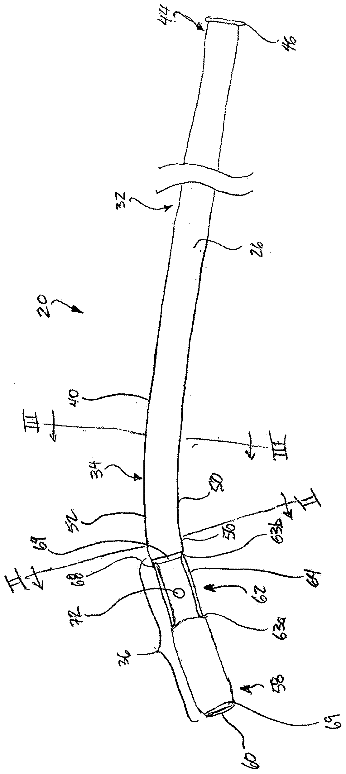 Vascular anchoring introducer sheath