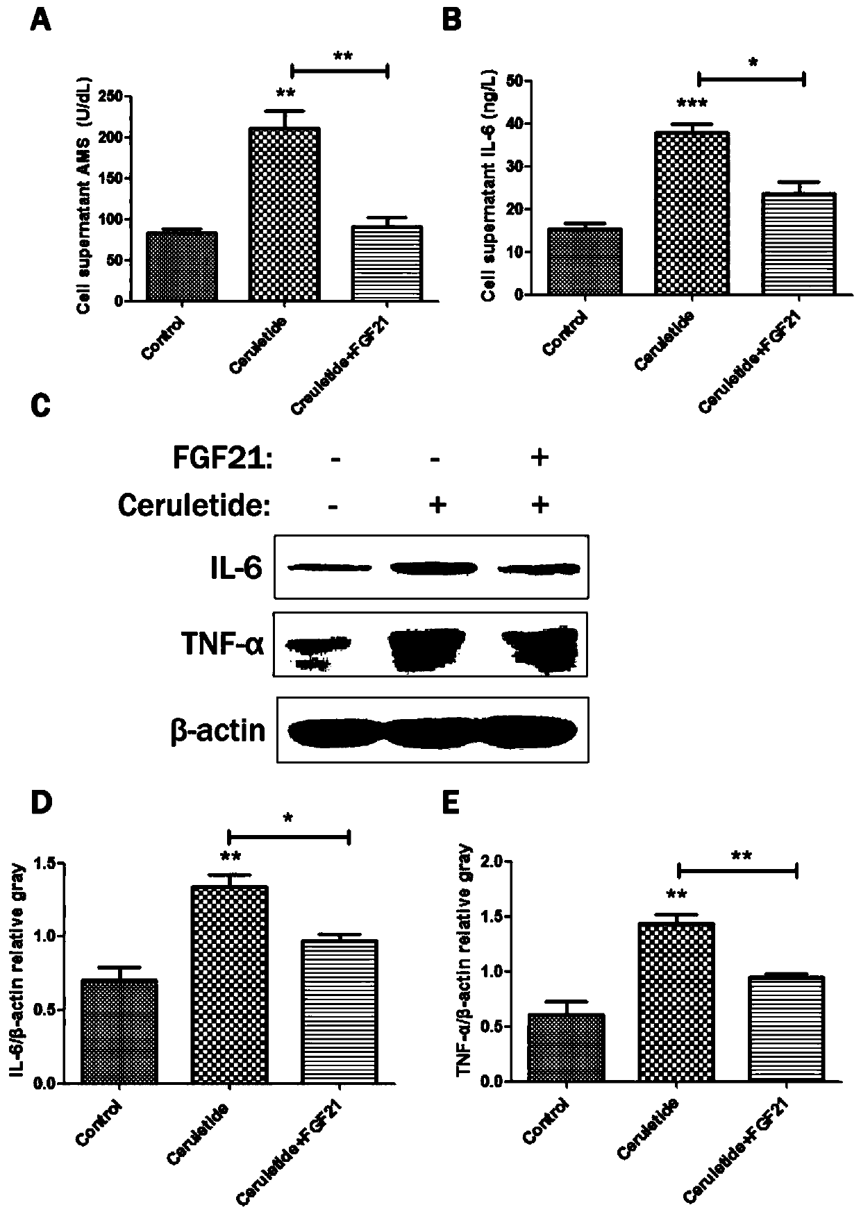 Application of fibroblast growth factor 21 (FGF 21) in preparation of drugs for treating acute pancreatitis