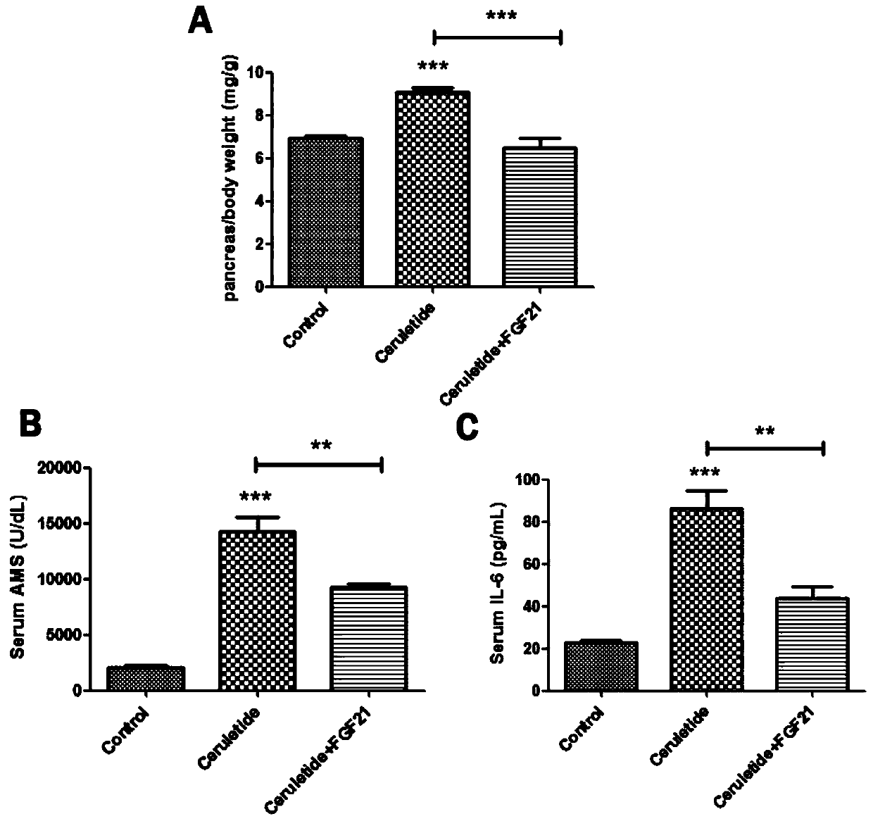Application of fibroblast growth factor 21 (FGF 21) in preparation of drugs for treating acute pancreatitis