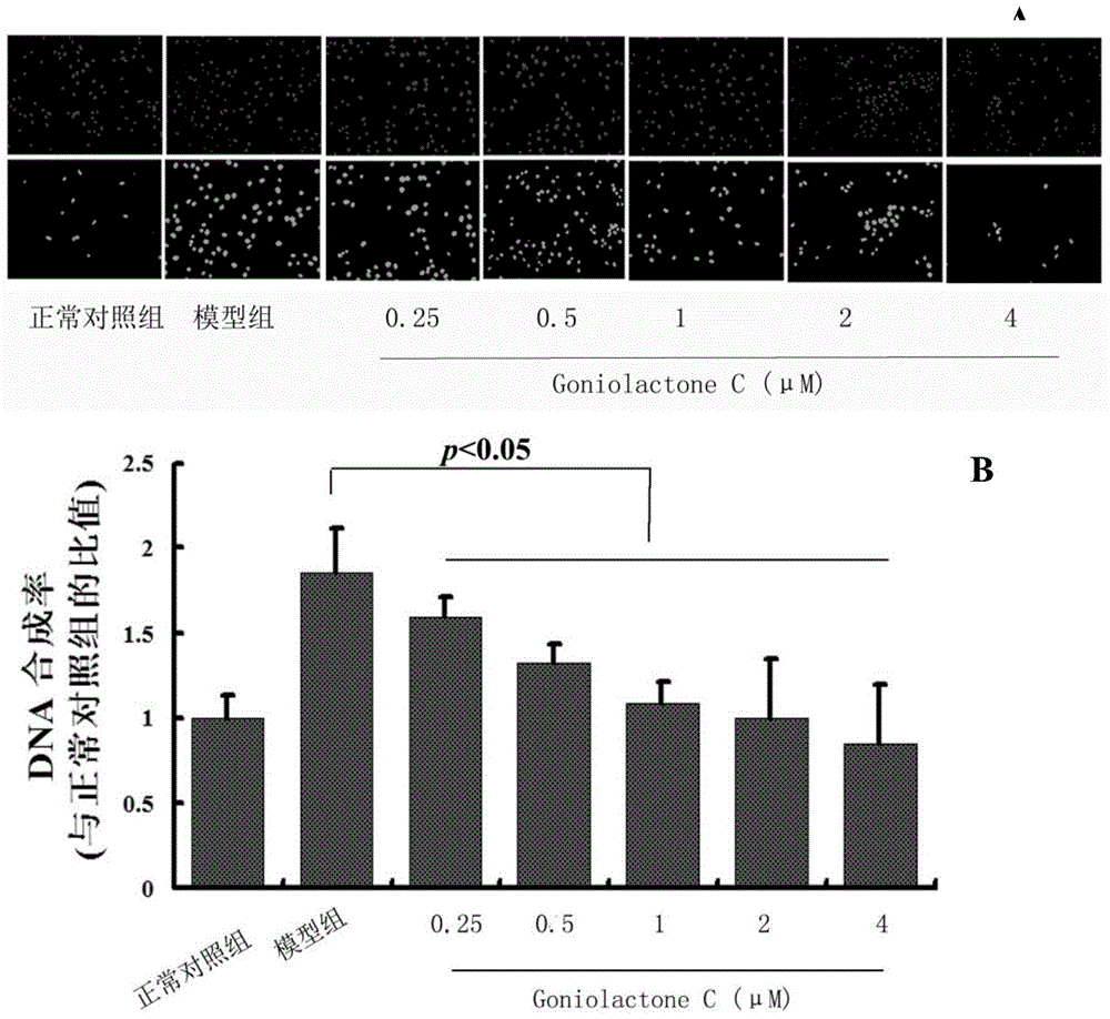 Application of goniolactones C to suppressing proliferation and migration of vascular smooth muscle cells