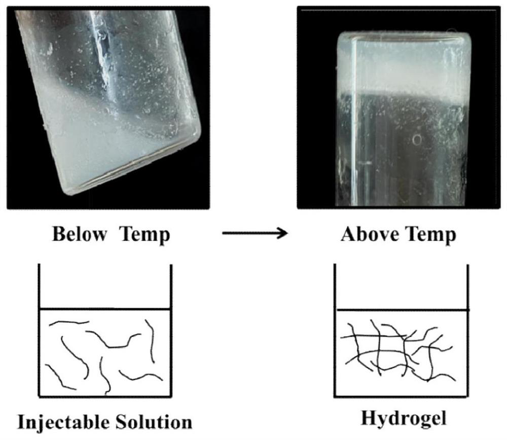 Preparation method and application of implantable in-situ formed chitosan hydrogel