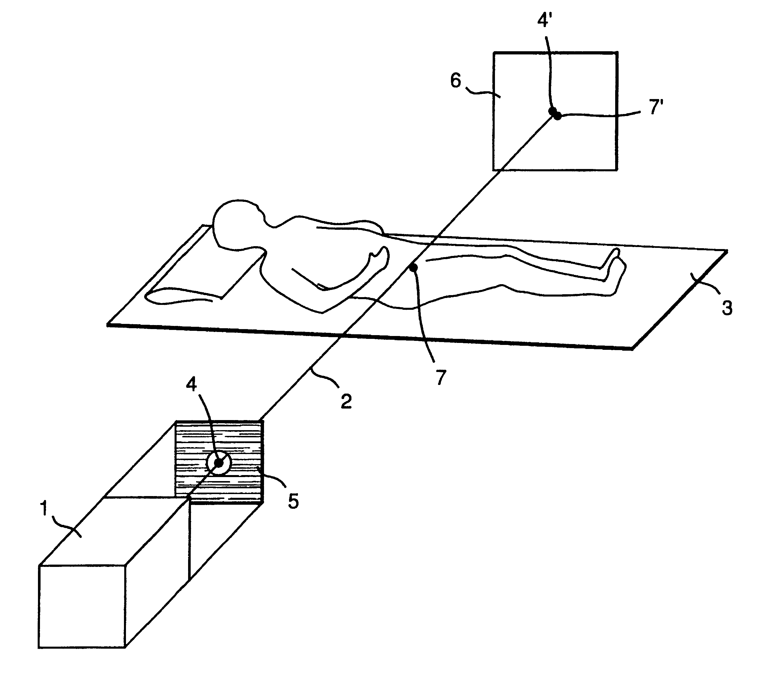 Arrangement and reference means to direct a beam in radiation therapy