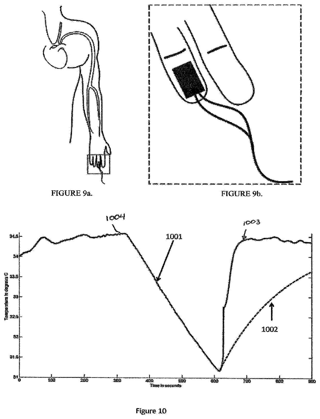 Methods and apparatus for assessing vascular health
