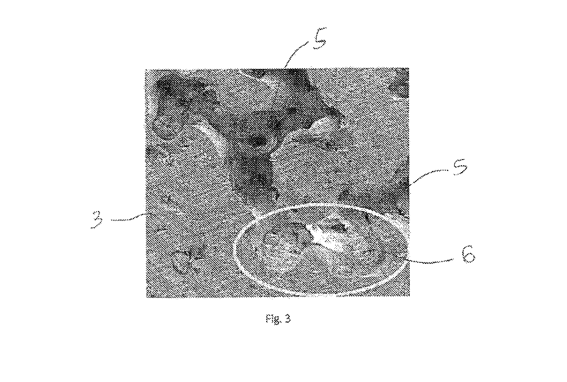 Biomaterial and method for its realisation