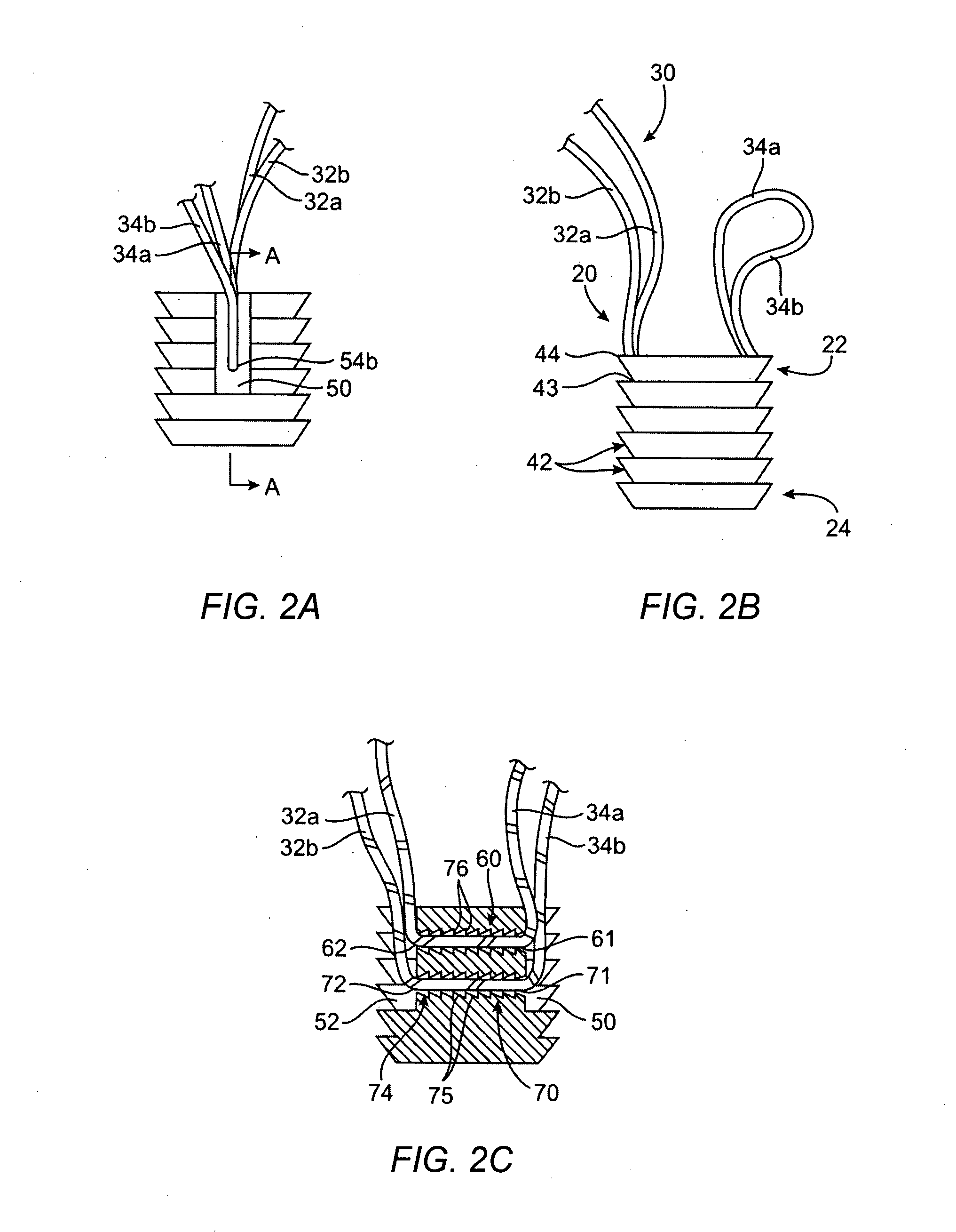 Bone anchor installer and method of use