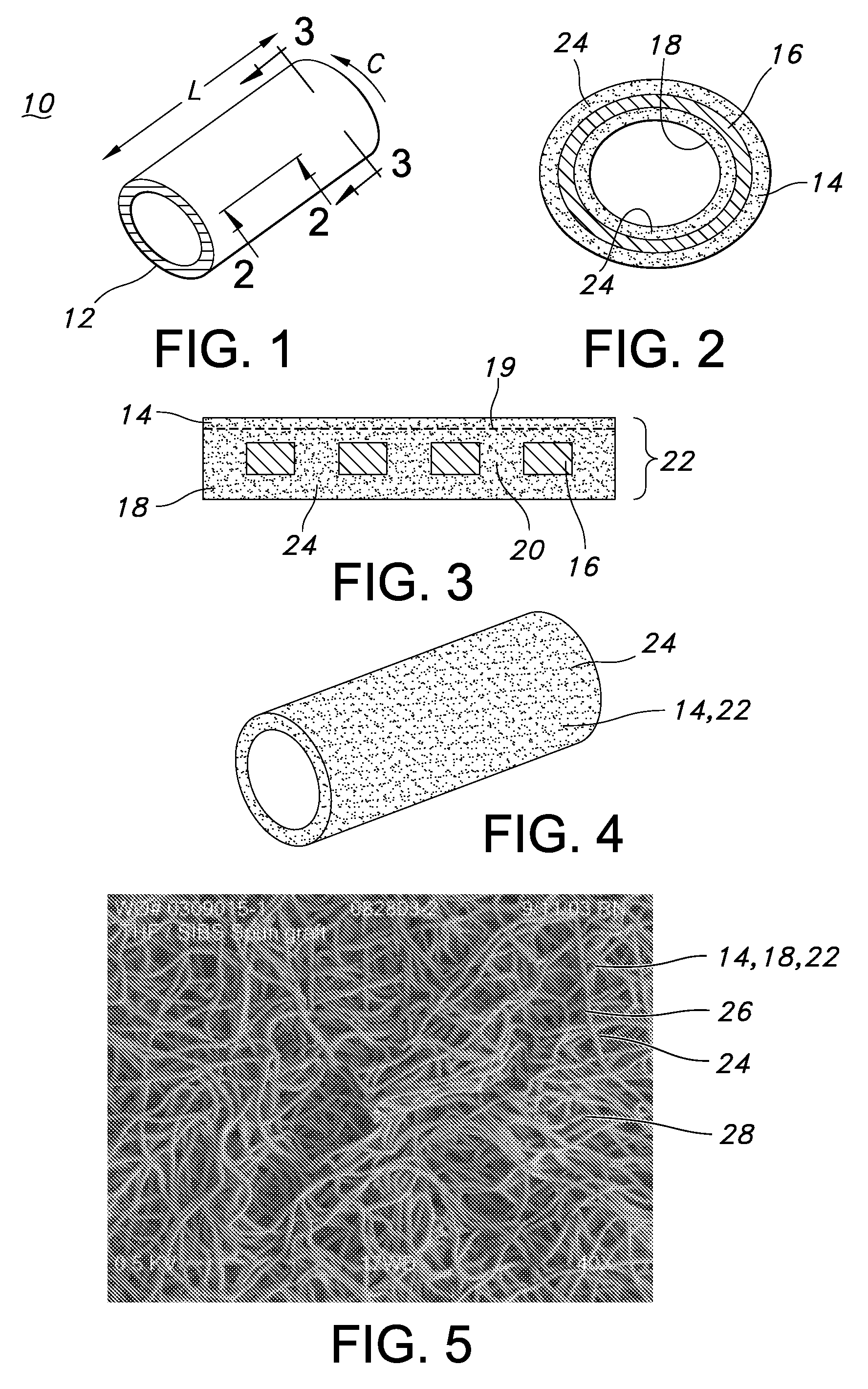 Blood acess apparatus and method