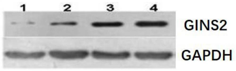 Ging2 gene knockout in epidermal stem cells using CRISPR-Cas system