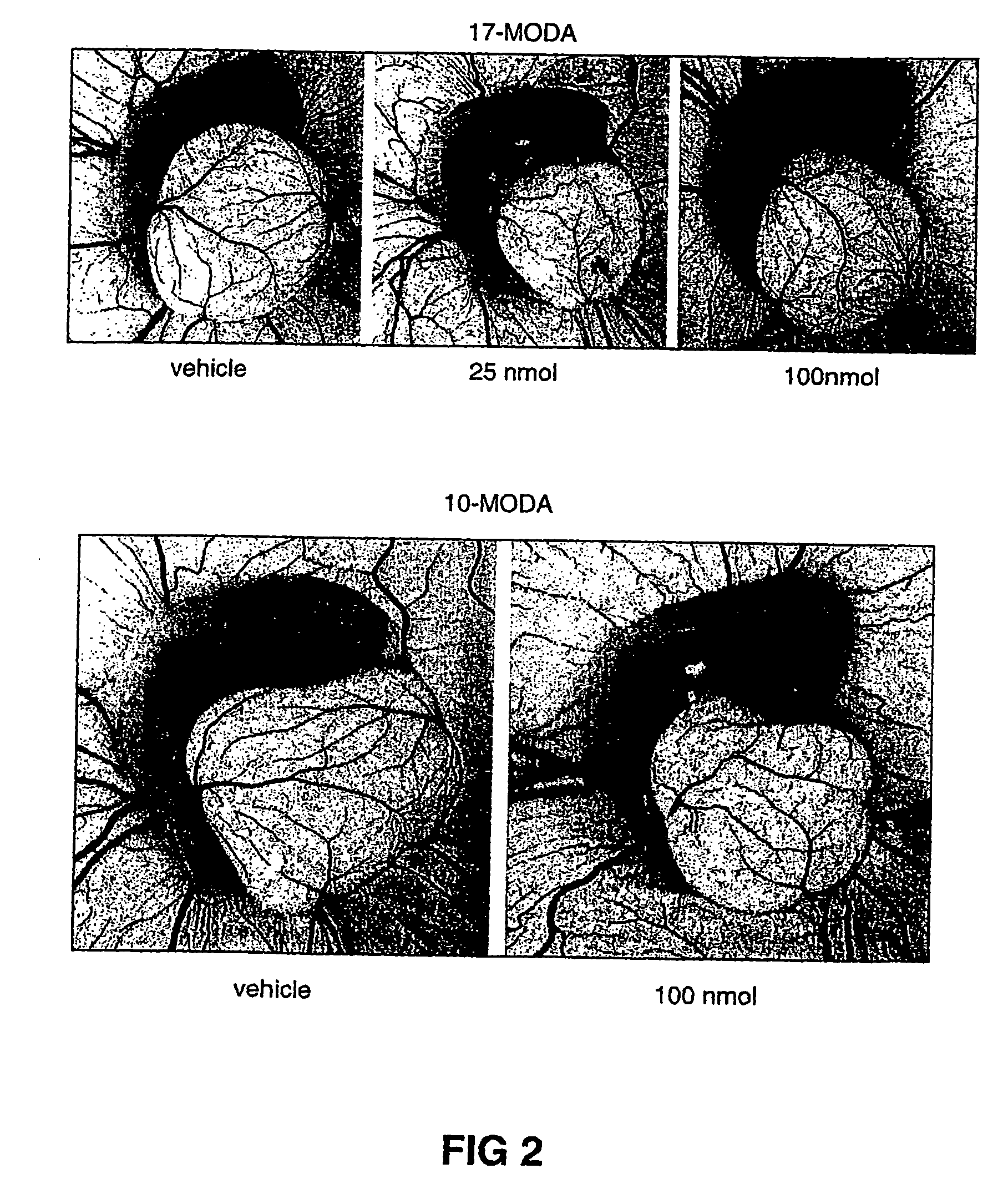 Method of inhibiting angiogenesis