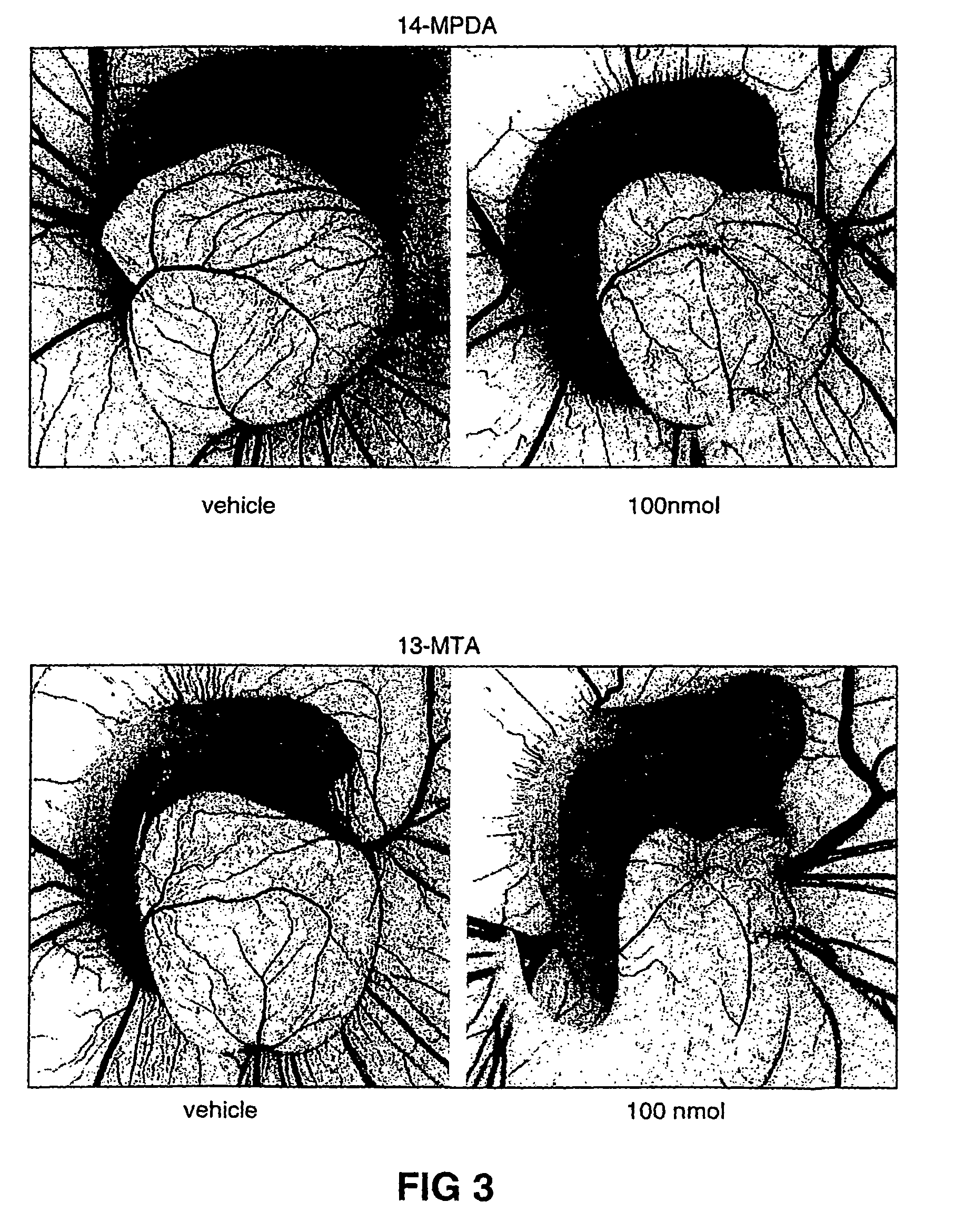 Method of inhibiting angiogenesis