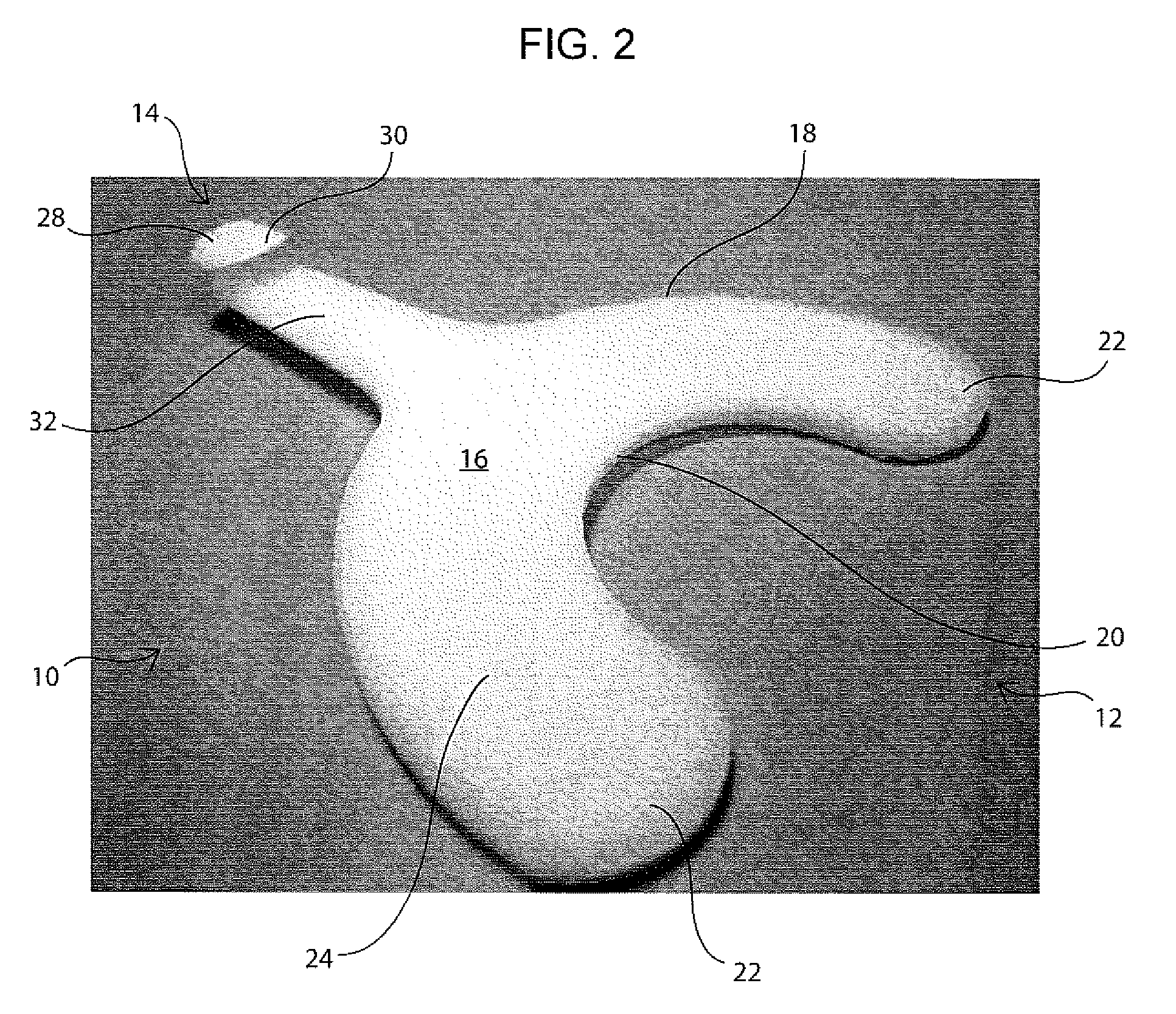 Dental aligner seating and removal tool and method of use