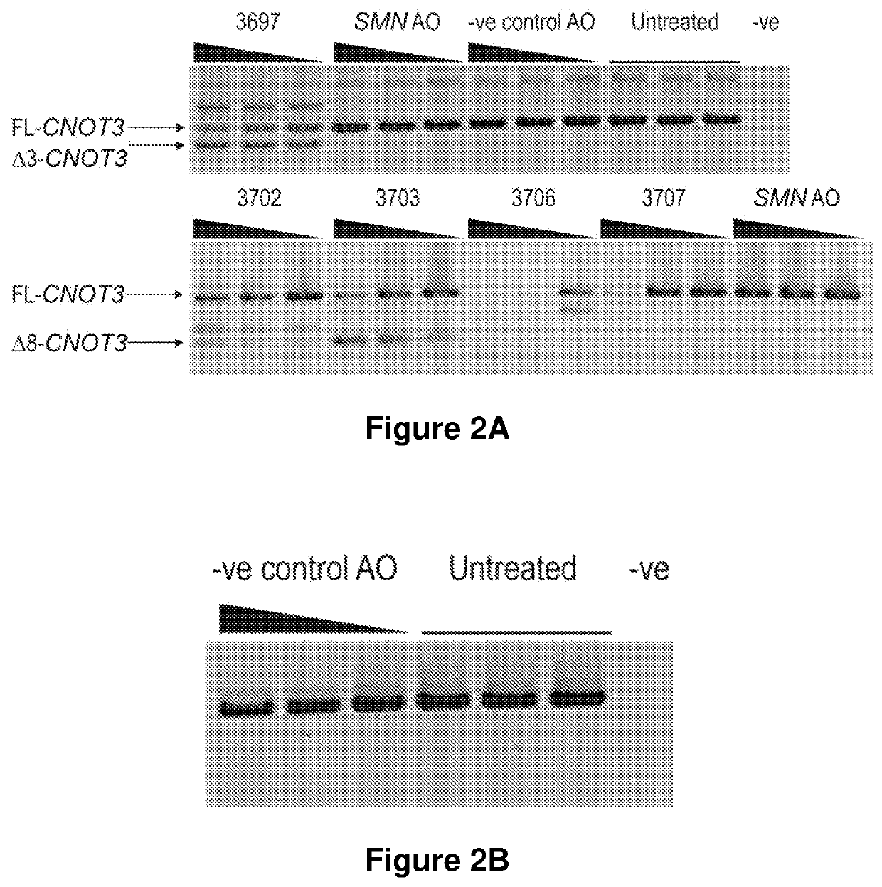 Novel Retinitis Pigmentosa Treatment