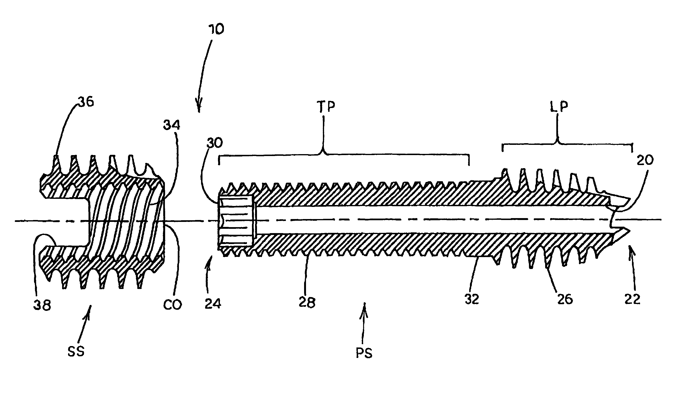 Compression screw apparatuses, systems and methods