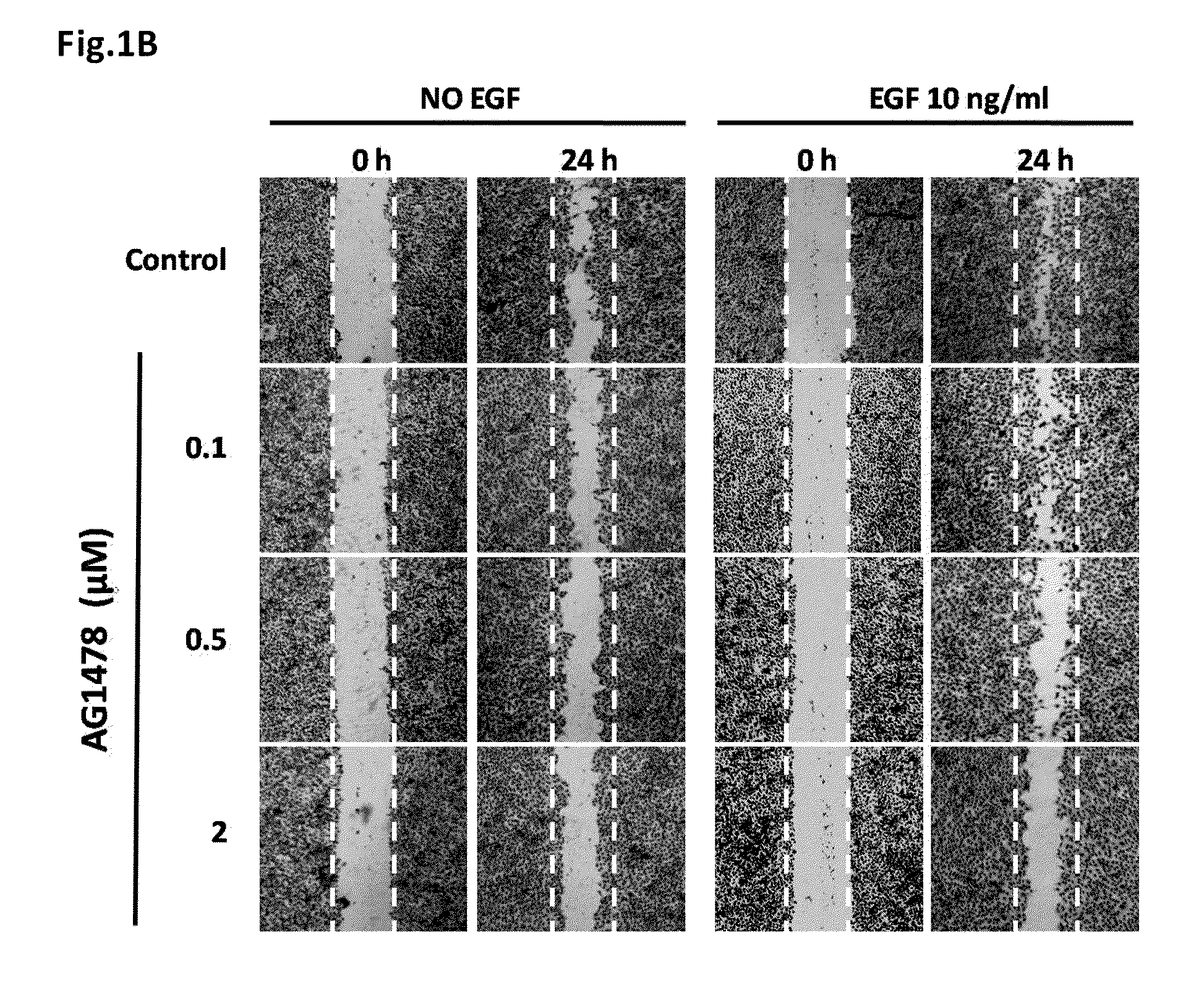 Uses of an Immunomodulatory Protein (GMI) from Ganoderma Microsporum