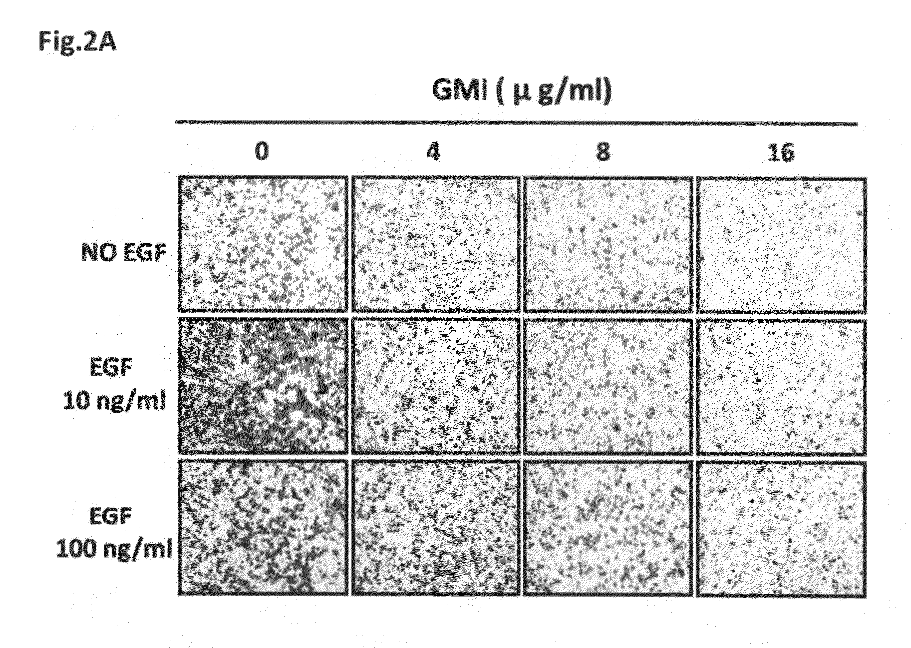 Uses of an Immunomodulatory Protein (GMI) from Ganoderma Microsporum
